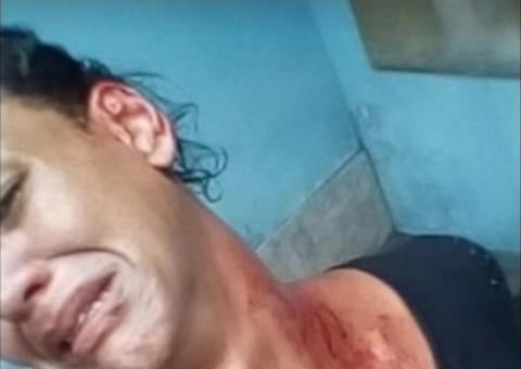 Transexual é agredida com barra de ferro à luz do dia