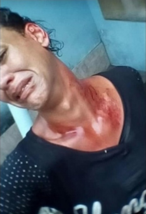 Transexual é agredida com barra de ferro à luz do dia