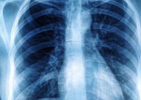 Pediatras pedem cautela em exames por imagens em crianças e falam sobre riscos