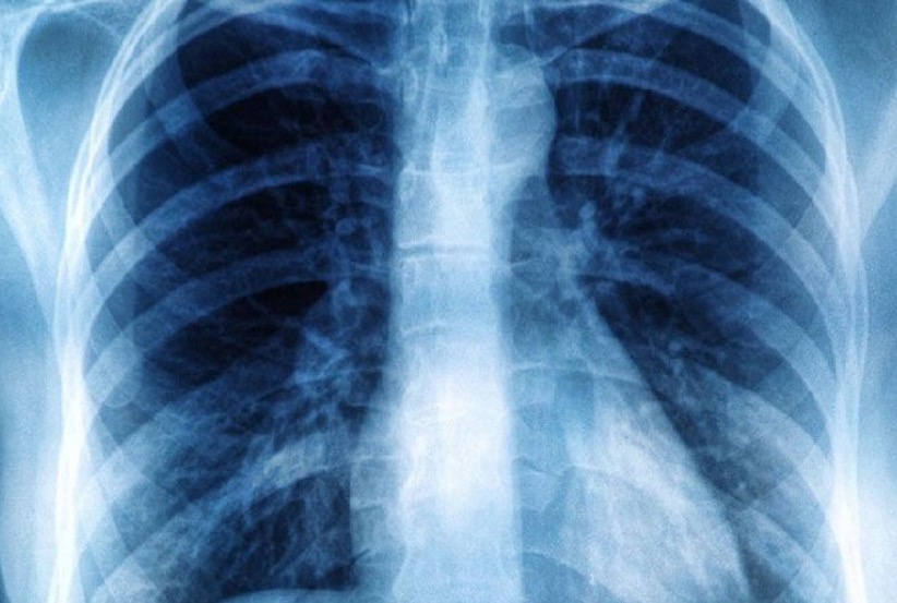 Pediatras pedem cautela em exames por imagens em crianças e falam sobre riscos