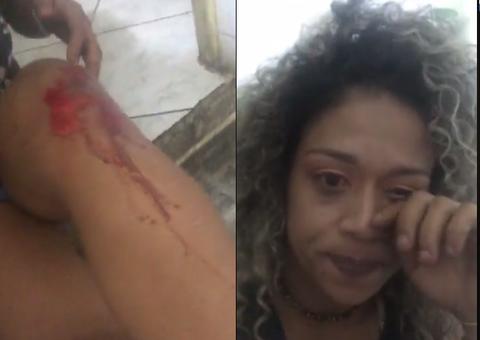 Confundida com travesti, empresária é agredida por homem ao sair de show em Manaus