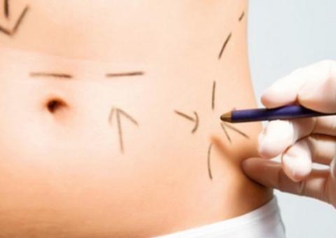 Mulher morre após realizar procedimento estético nos glúteos