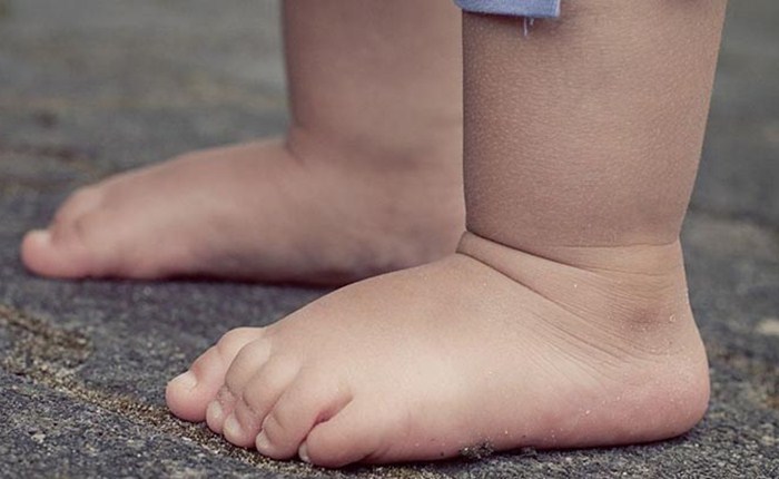 Pai é preso suspeito de estuprar filha de três anos no Amazonas