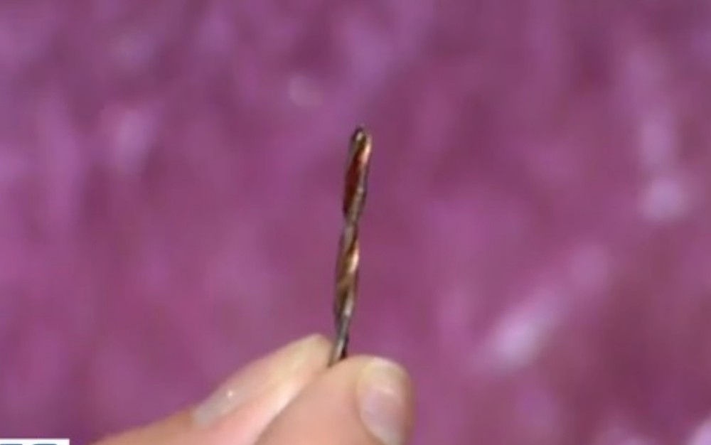 Mulher fica com broca dentro do corpo após operar o cotovelo