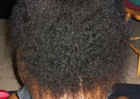 Novo enigma intriga internet 'Qual parte do corpo você vê?'