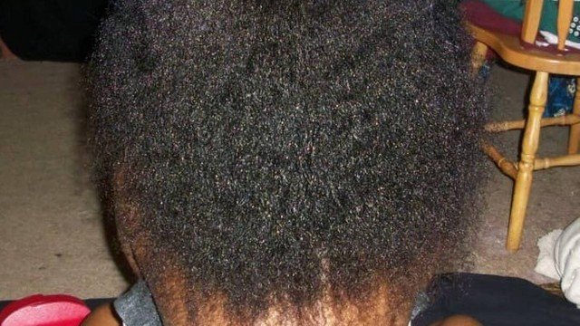 Novo enigma intriga internet 'Qual parte do corpo você vê?'