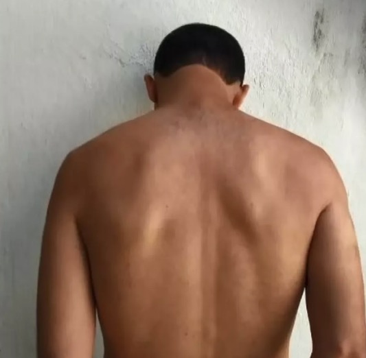 Pai é preso e confessa ter envenenado filho de 7 anos com soda cáustica