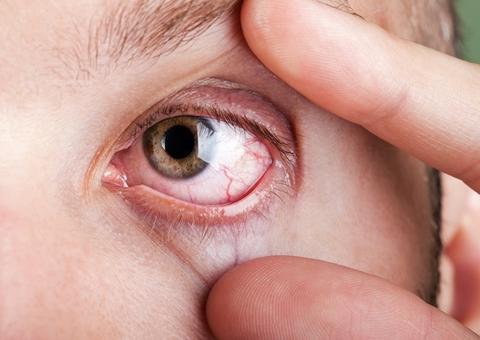 3 doenças que afetam o corpo mas que também podem comprometer a visão