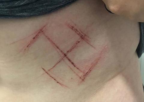 Jovem marcada com suástica será indiciada por falso testemunho