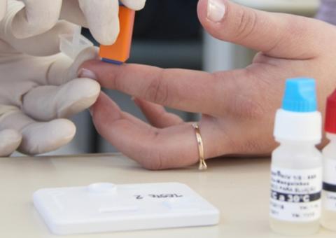 Ação oferta testes rápidos de HIV e requisição de exames em Manaus