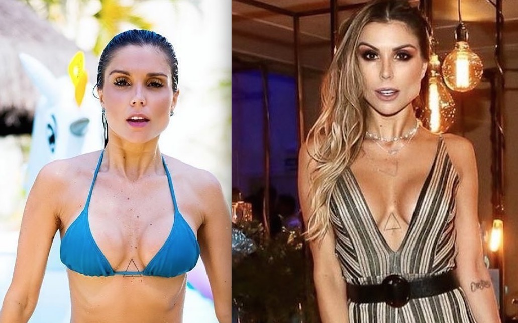 Flávia Viana surge com rosto diferente após procedimento estético e da o que falar