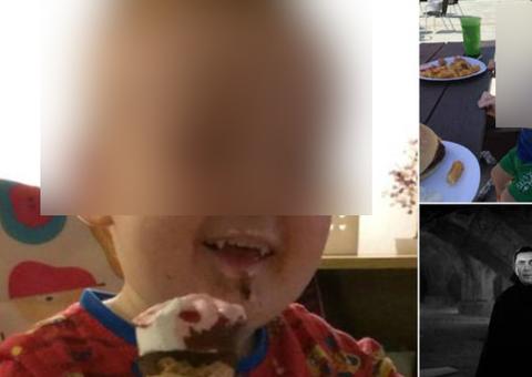 Criança desenvolve dentes de vampiro em uma semana