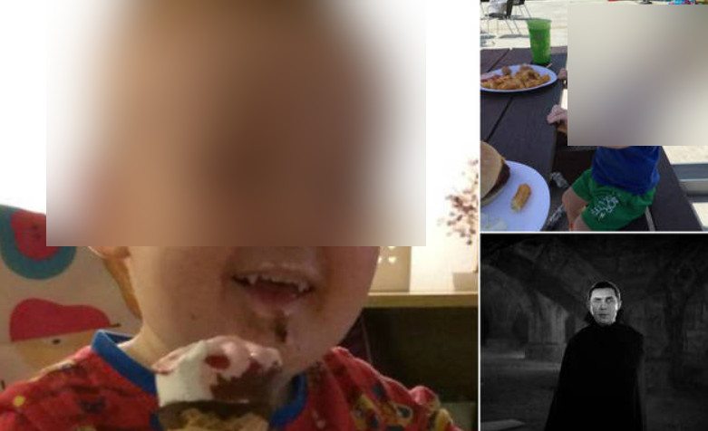 Criança desenvolve dentes de vampiro em uma semana