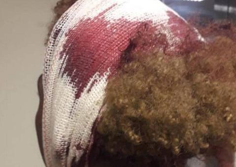 Alunos levam paulada dentro de colégio e acusam homofobia 'Eu vou matar vocês'