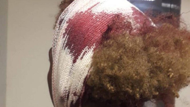 Alunos levam paulada dentro de colégio e acusam homofobia 'Eu vou matar vocês'