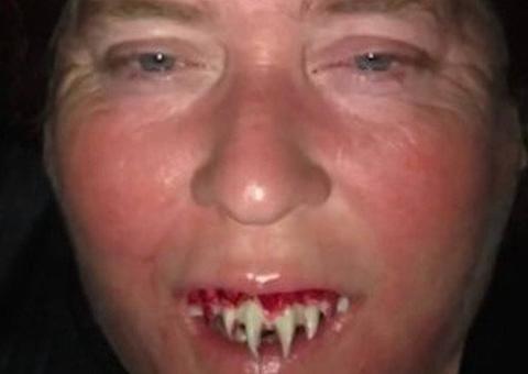 Mulher compra dentes postiços de vampiro para fantasia e pior acontece