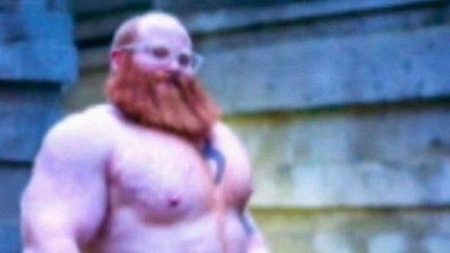 Homem injeta silicone nos testículos para culto sexual e pior acontece