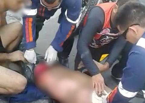 Homem tem parte do corpo queimado ao esbarrar em fiação elétrica em Manaus