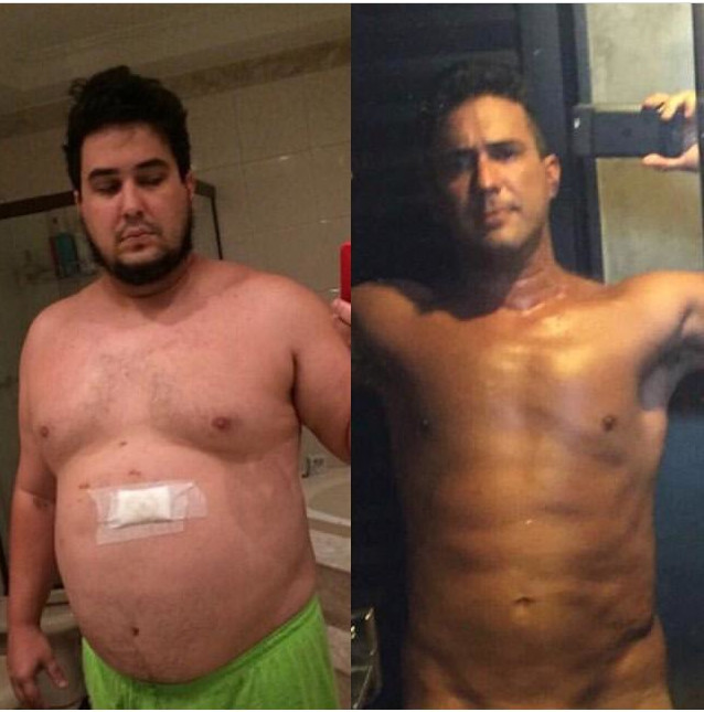 André Marques faz desabafo ao mostrar foto de antes e depois de cirurgia: 'Estava no fundo do poço'