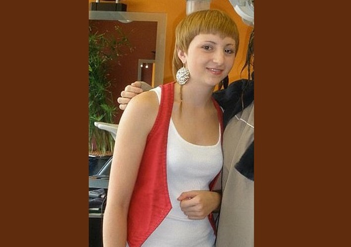 Jovem surge irreconhecível após sofrer anos de bullying por aparência