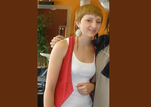 Jovem surge irreconhecível após sofrer anos de bullying por aparência