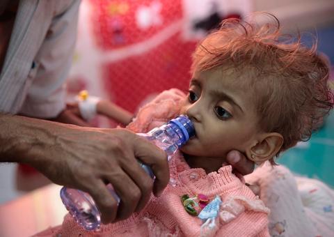 Fome e doenças mataram quase 85 mil crianças no Iêmen desde 2015