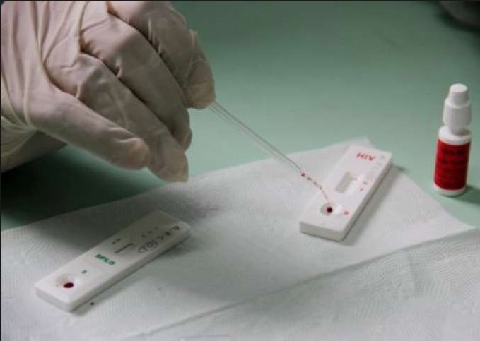 Dia da Luta contra a Aids tem testes rápidos de HIV e distribuição de preservativos