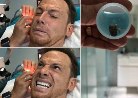 Apresentador passa por horripilante cirurgia para retirar barata morta do ouvido