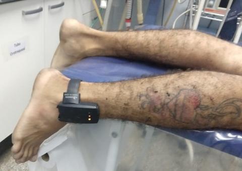 Dupla suspeita de balear homem em assalto é espancada por populares em Manaus