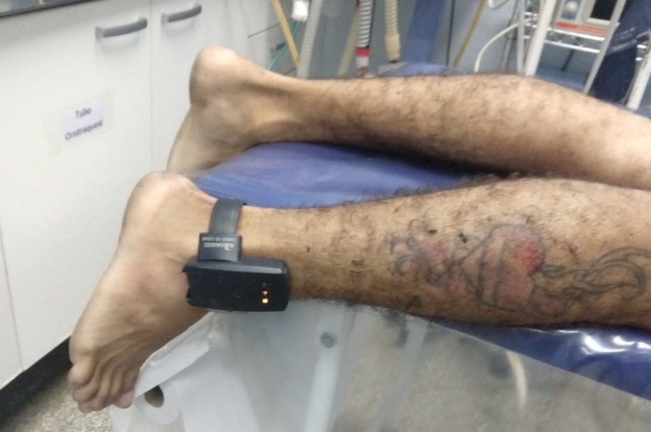 Dupla suspeita de balear homem em assalto é espancada por populares em Manaus