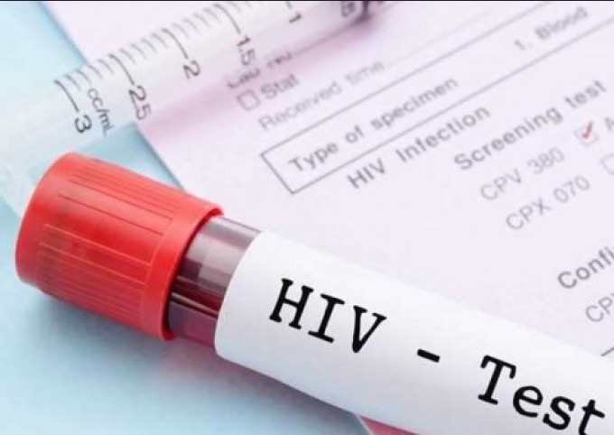 Programação do Dezembro Vermelho é preparada em Manaus