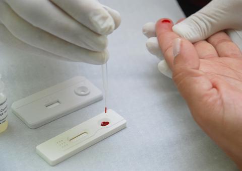 Campanha contra aids tem foco na ampliação de testes para diagnóstico
