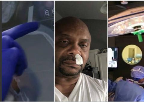 Homem descobre que coriza era vazamento de fluido cerebral