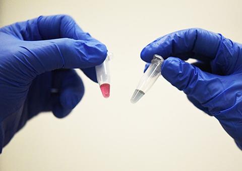 Pesquisadores criam teste de 10 minutos capaz de detectar câncer