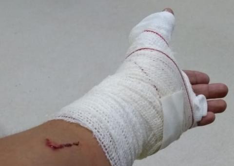 Tiroteio causa pânico e deixa homem ferido em terminal de ônibus em Manaus