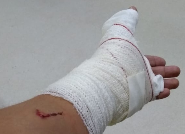 Tiroteio causa pânico e deixa homem ferido em terminal de ônibus em Manaus