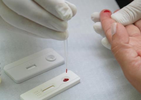 Ação oferta testes rápidos de HIV, hepatites e exame de turberculose em Manaus