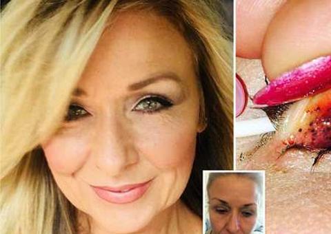 Mulher quase fica cega após passar 25 anos sem retirar rímel dos olhos