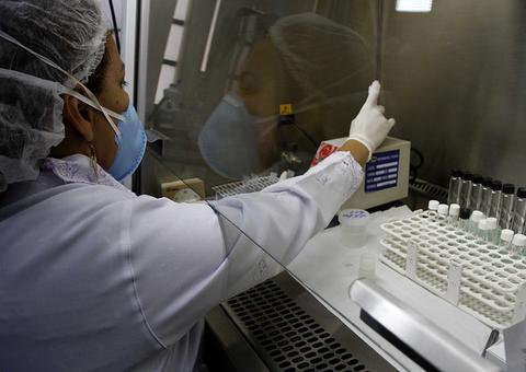 UBS Leonor Brilhante inicia novo serviço de atendimento à pessoas com HIV