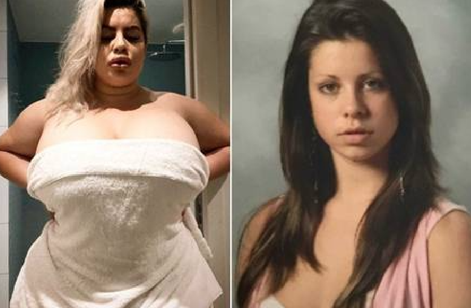 Mulher injeta 5 litros de gordura para ter o maior bumbum do mundo