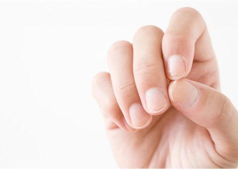 Saiba o que são aquelas manchas brancas nas unhas e como evitar