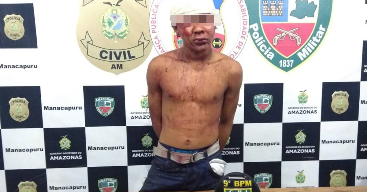 Mãe e bebê são baleados durante tentativa de assalto no Amazonas 