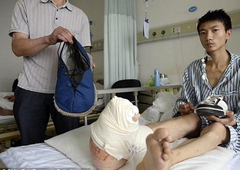 Jovem com pé maior que outro sofre risco de amputação