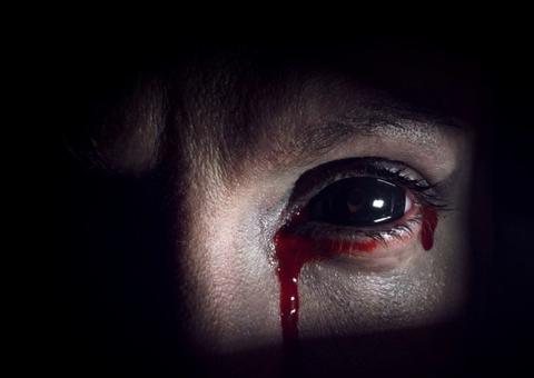 No hospital, jovem choca médicos ao chorar lágrimas de sangue