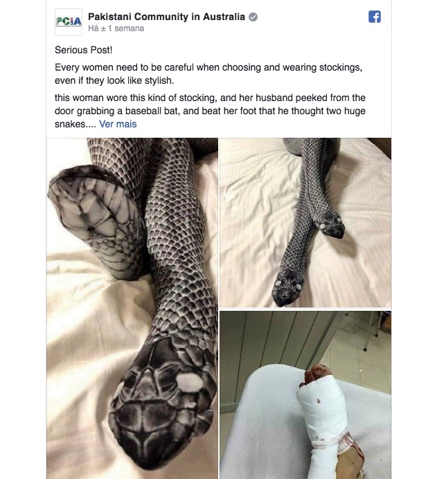 Mulher usa meia-calça de cobra, assusta marido e o pior acontece