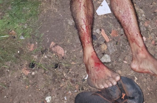 Com tiro no pulmão, homem é encontrado morto dentro de matagal em Manaus