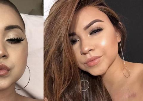  Blogueira brasileira morre aos 16 anos após luta contra câncer