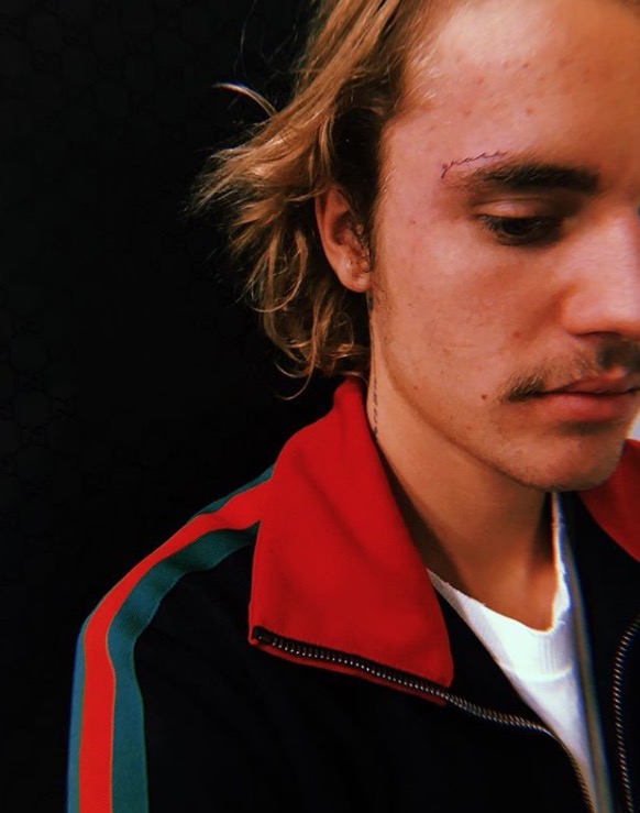 Justin Bieber faz tatuagem no rosto; veja o resultado