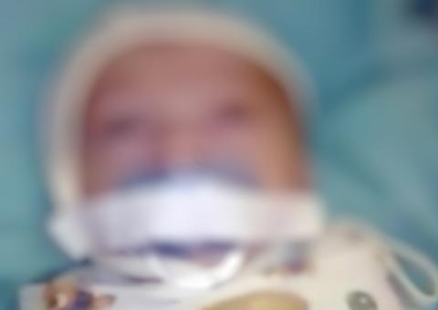 Vídeo chocante mostra bebê com chupeta presa por esparadrapo em hospital