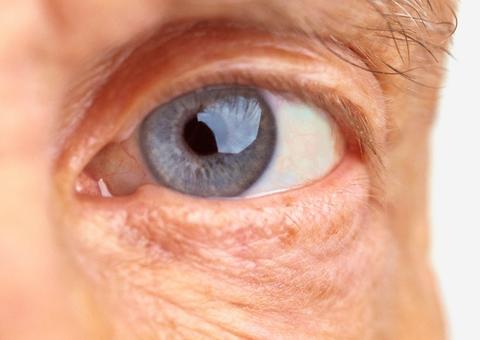 SUS oferece novo tratamento para pacientes com degeneração da retina